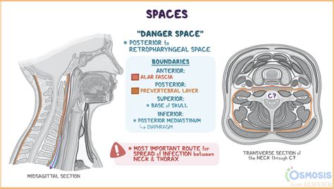 soacle|space deutsch.